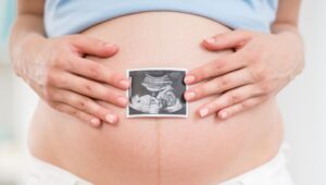 Flacidez Pós-parto: O Que é, Principais Motivos e Como Evitar